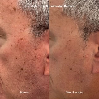 Dynamic Age Defense SPF30