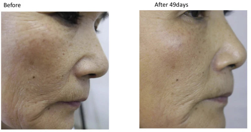 CO2 Carboxy Mousse Moisturizer