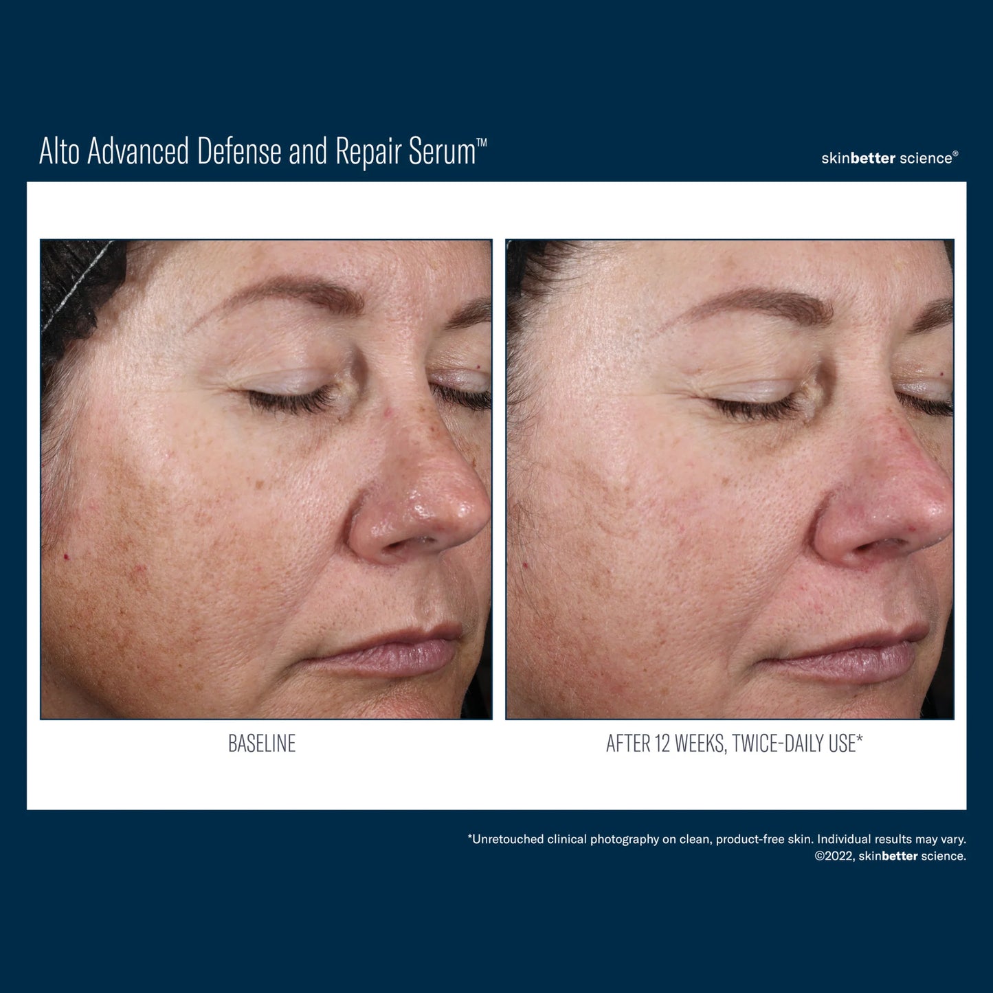 Alto Advanced Defense and Repair Serum