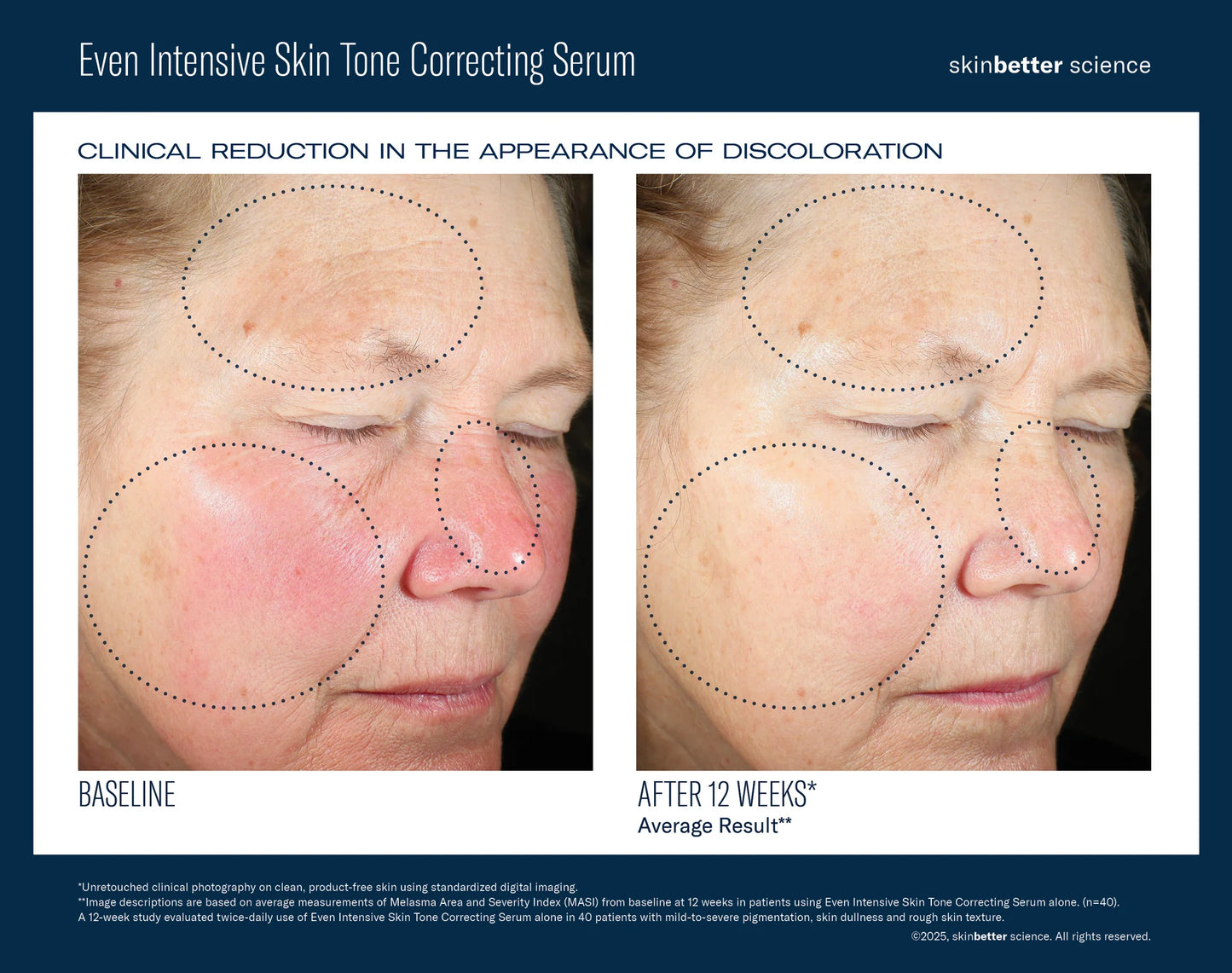 Even Intensive Skin Correcting Serum