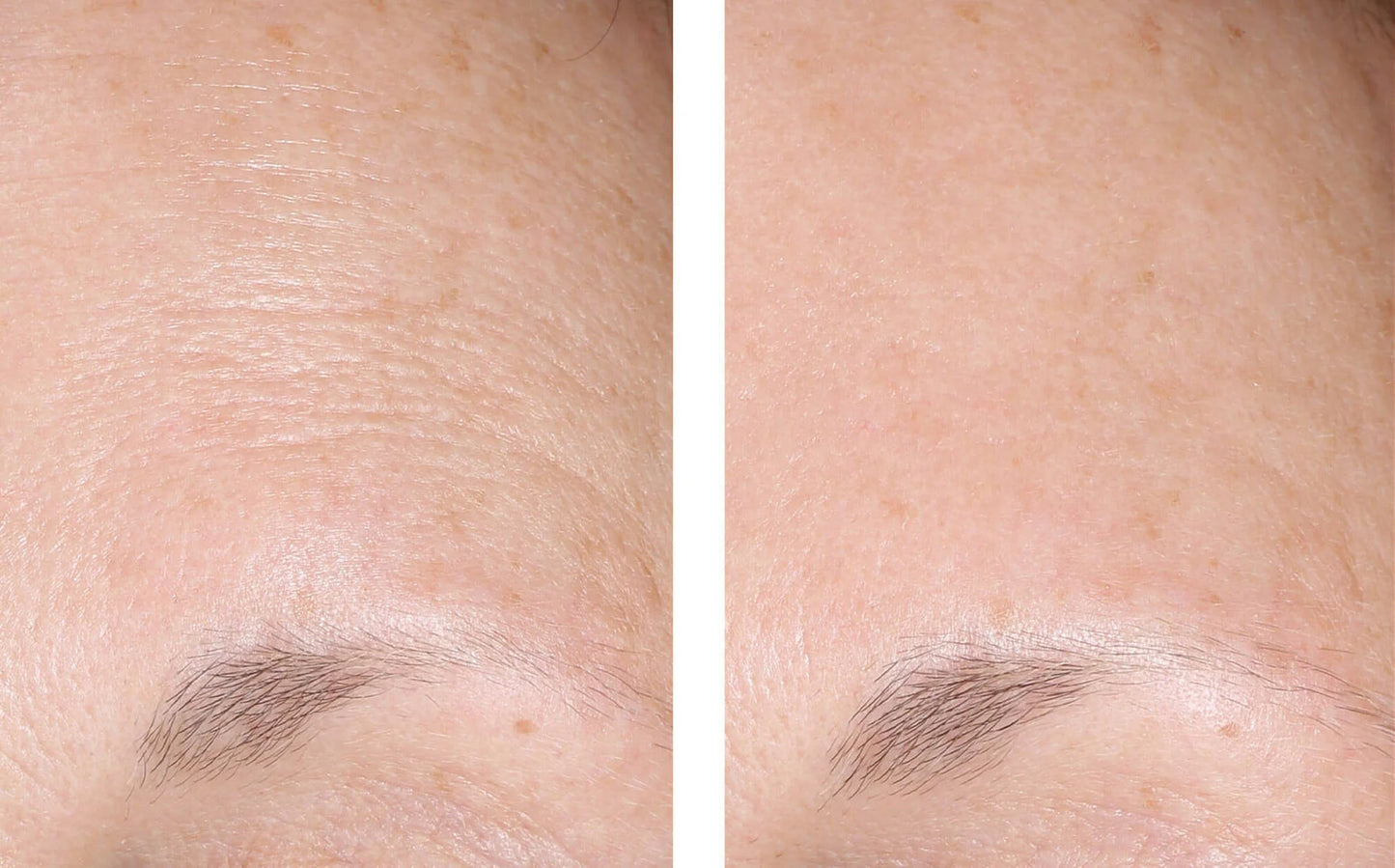 Alpharet Overnight Cream