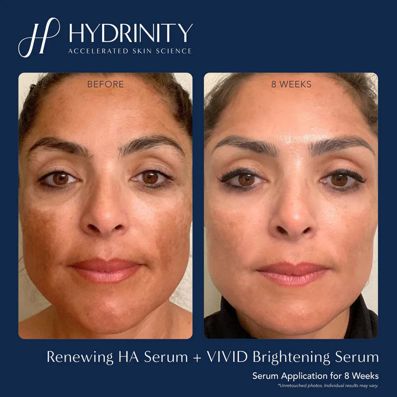 Vivid Brightening Serum