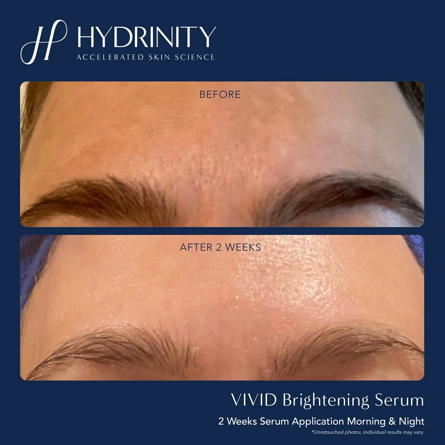 Vivid Brightening Serum