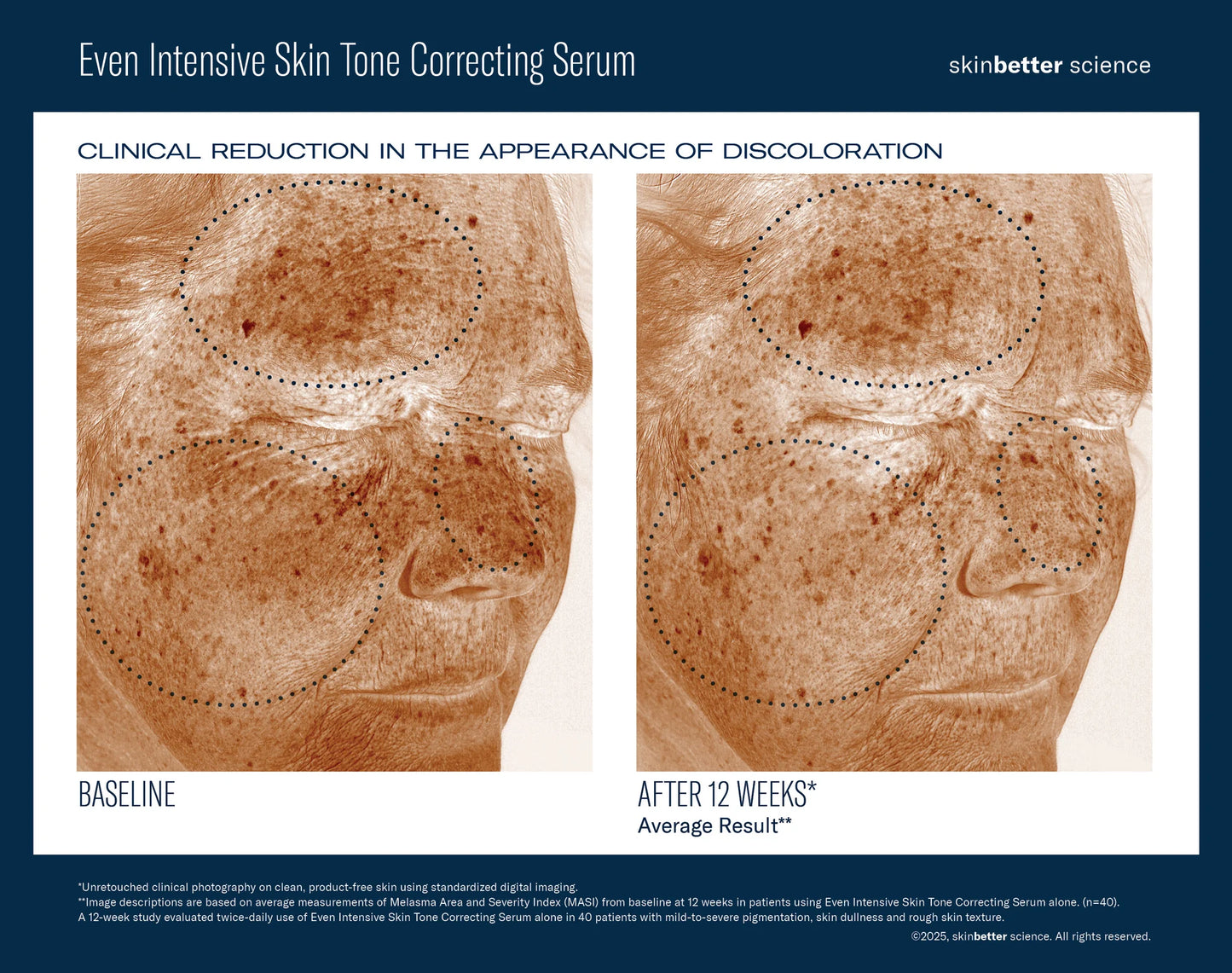 Even Intensive Skin Correcting Serum