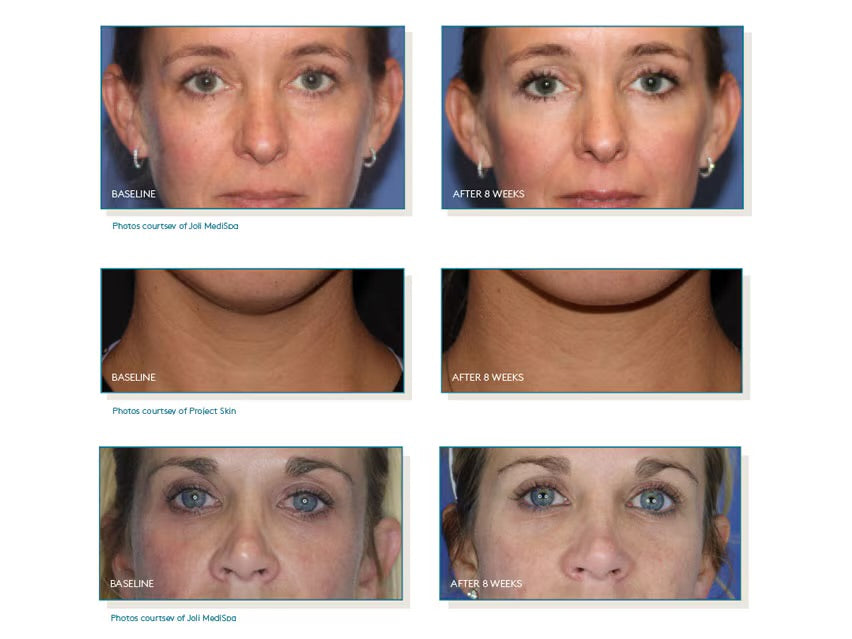 PEP UP COLLAGEN BOOST FACE & NECK SERUM