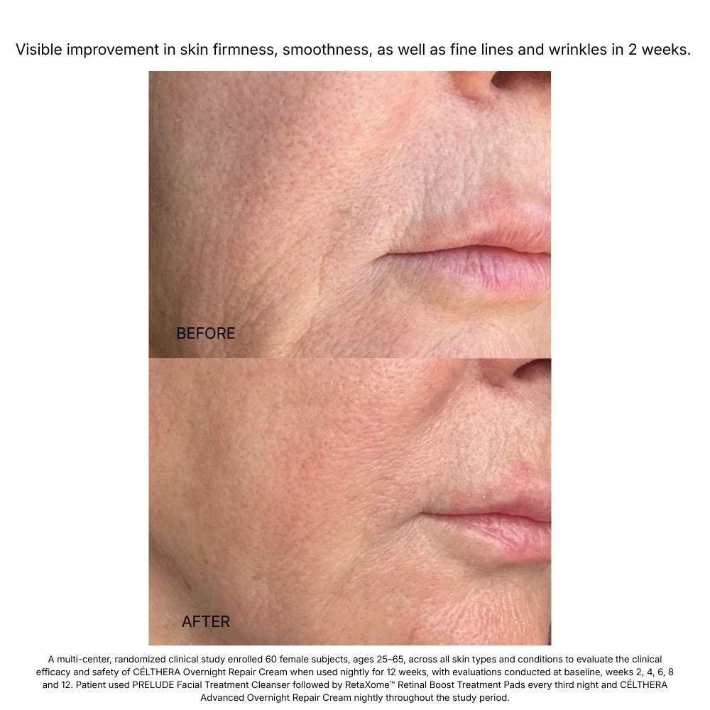 Celthera Advanced Overnight Repair Cream (Preorder More Here)