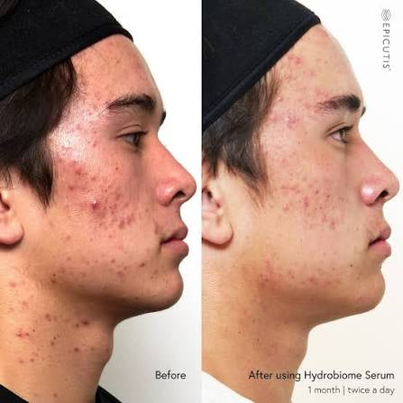 Hydrobiome Serum